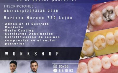 FULL BONDING: Odontología restauradora directa en el sector posterior
