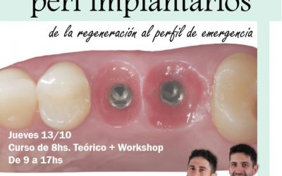Manejo de tejidos peri implantarios